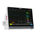 MONITOR-DE-SIGNOS-VITALES-DE-5-PARAMETROS